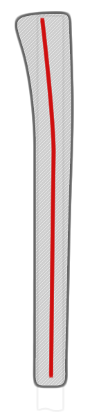cross-section illustration of typical pistol grip